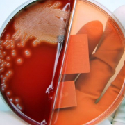 Recrudescence des formes graves d'infections invasives à streptocoque A (IISG)